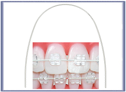 Damon* Shape Tooth Coloured Super Elastic Nickel Titanium  018'' x 025''  Universal