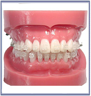 Purity� Consultation Models (Including Purity Brackets)