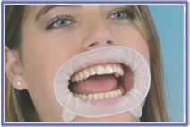 Optragate Regular Disposable Lip and Cheek Retractors