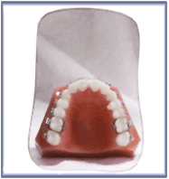Intra-Oral Photography Mirror No 3 Adult Occlusal
