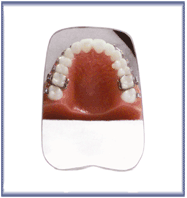 Intra-Oral Photography Mirror No 4 Child Occlusal