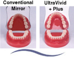 Ultravivid Plus Intra-Oral Photography Mirrors