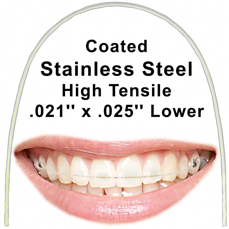 Euroform Cosmetic High Tensile Stainless Steel Rect .021'' x .025'' Lower Archwire