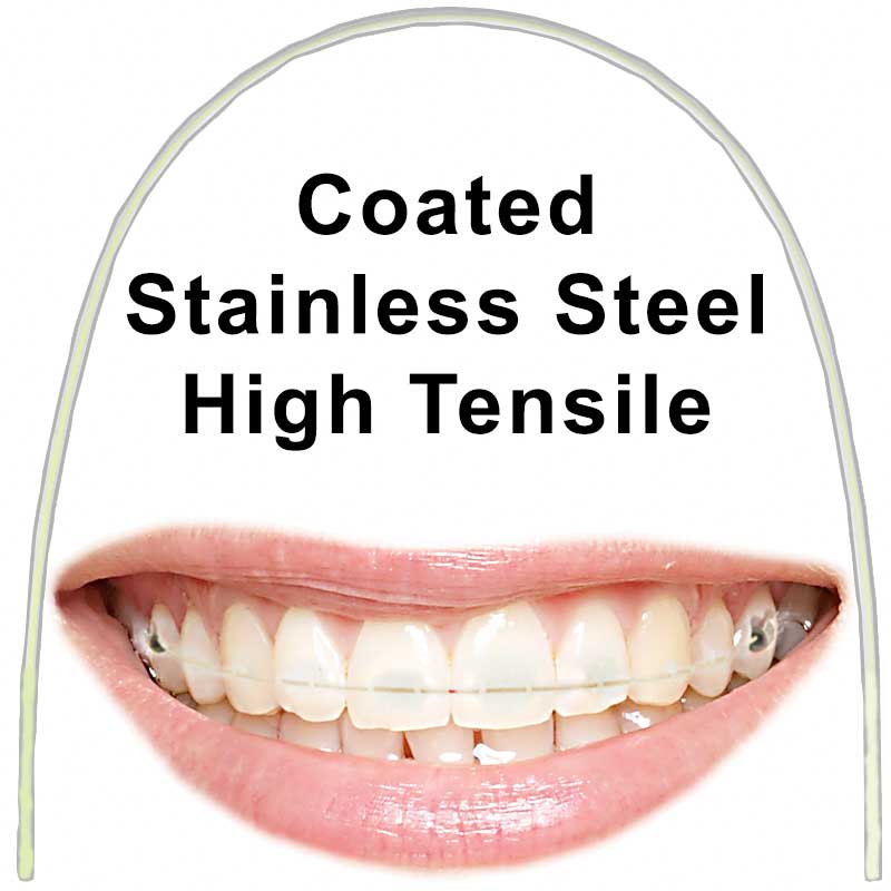 Euroform Cosmetic High Tensile Stainless Steel Archwires  