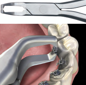 Hu-Friedy Lingual Bracket Removing Pliers