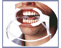 Full Arch Dry Field System Adult