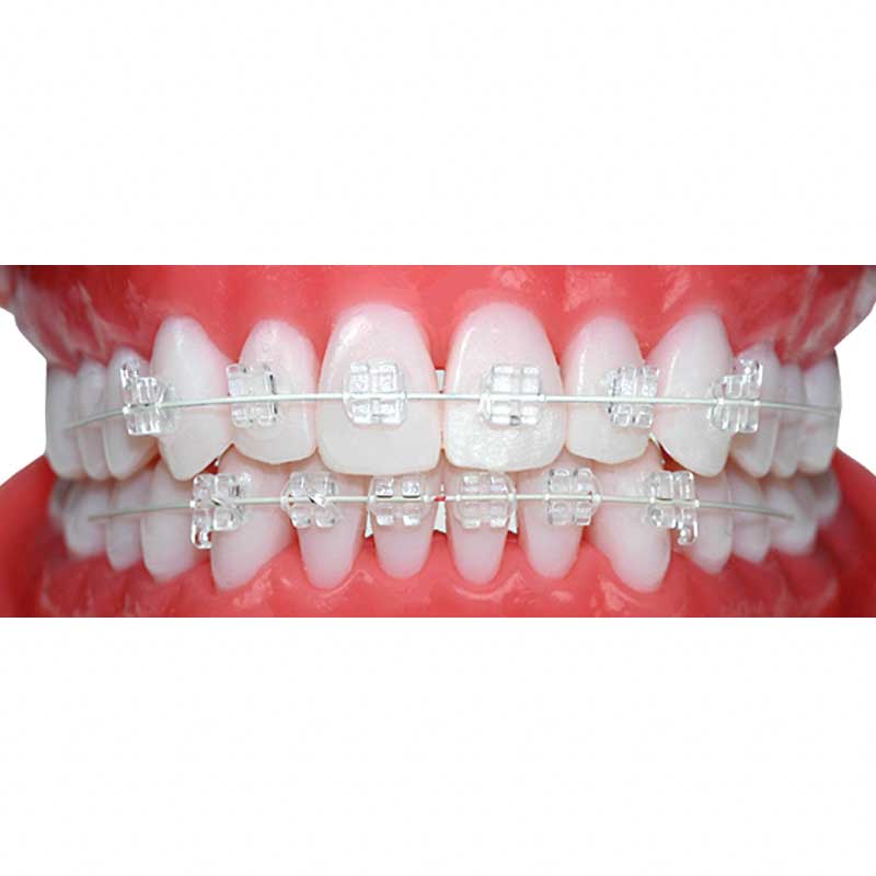 Cosmetic Wires
