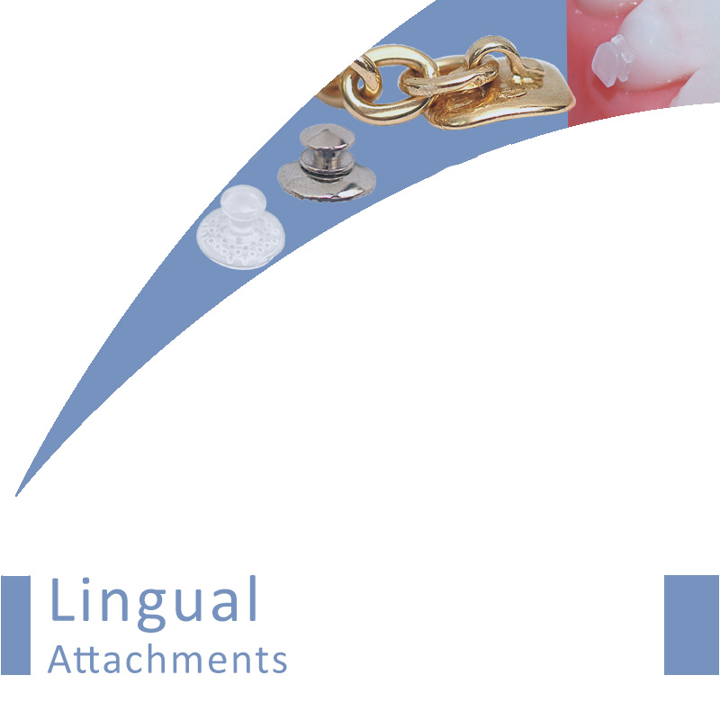 Lingual Attachments