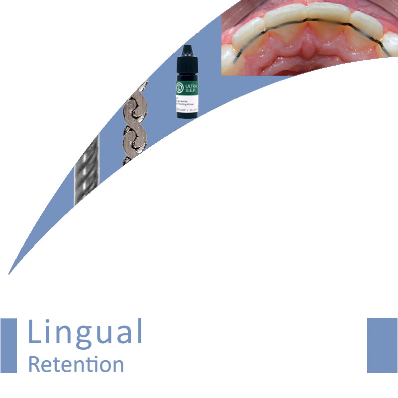 Lingual Retention