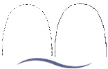 SLB Self Ligating Bracket Wires (Damon Compatible)