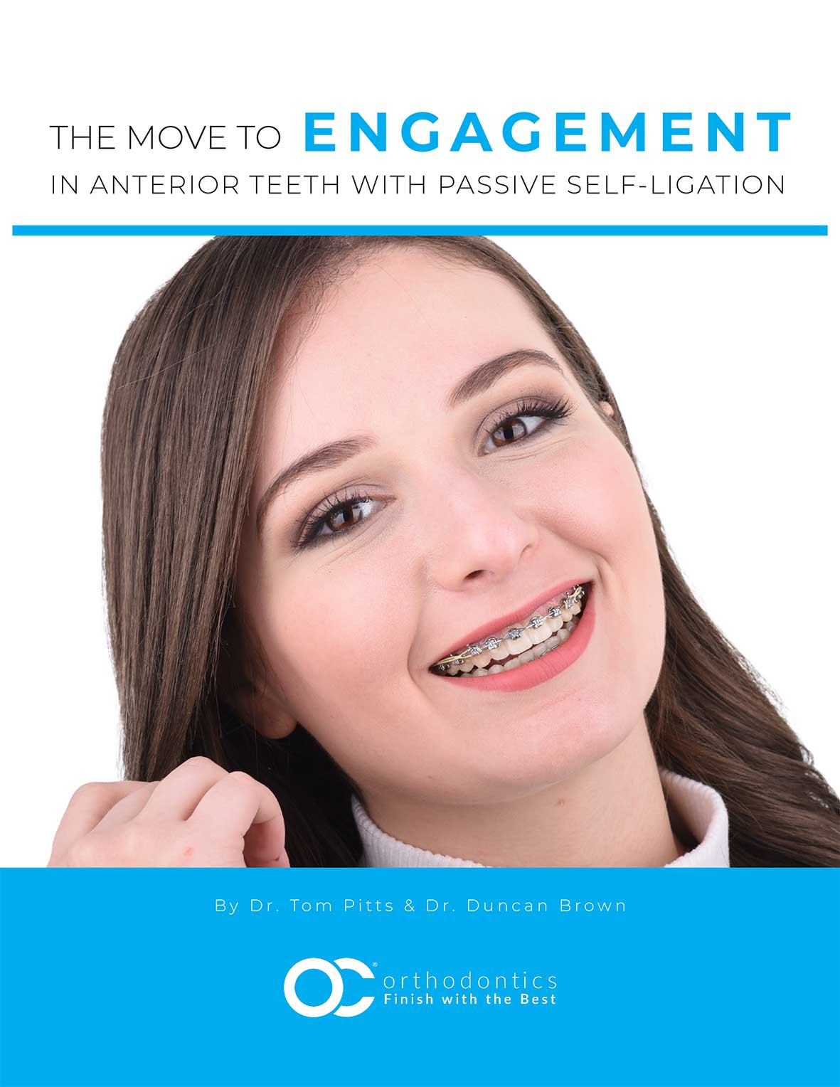 Pitts 21 - The Move To Engagement In Anterior Teeth With Passive Self-Ligation Pitts 21 - The Move To Engagement In Anterior Teeth With Passive Self-Ligation