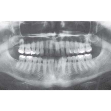 18 x 24cm Green Sensitive X-Ray Films