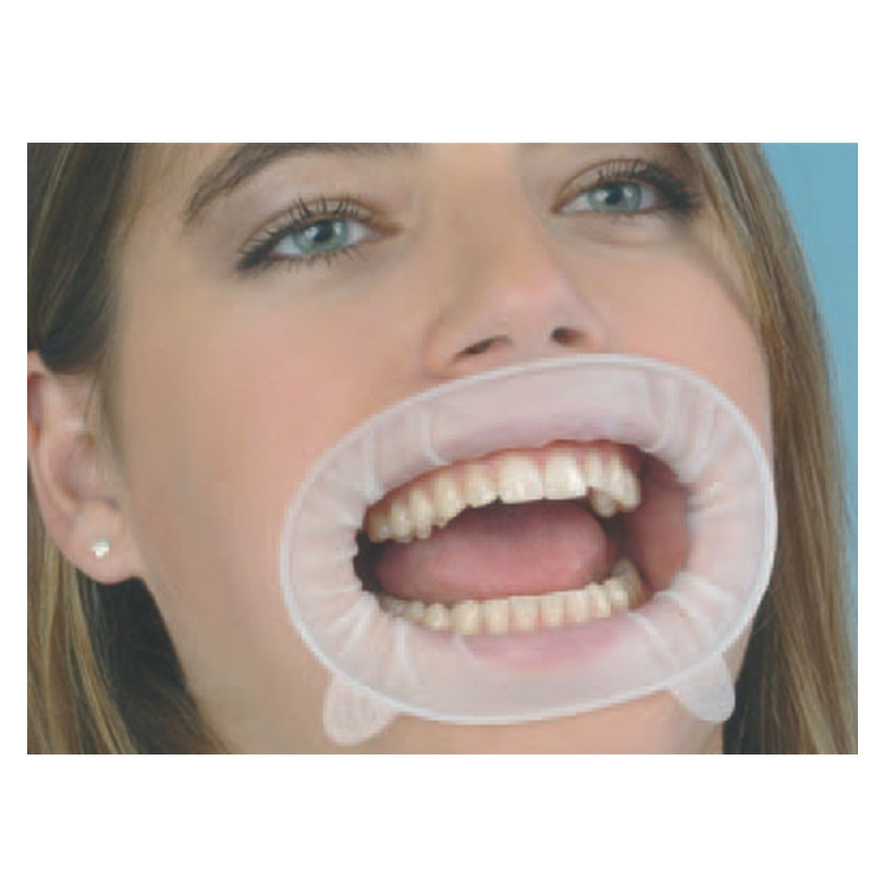 Mouth retractor on sale
