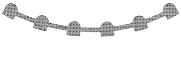 Lingual Retainer