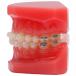 Typodont with Self Ligating Ceramic brackets - view 2