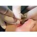 DENTATUS 5 PIECE FILE KIT AND HANDPIECE - view 4