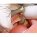DENTATUS 5 PIECE FILE KIT AND HANDPIECE - view 6