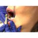 DENTATUS 5 PIECE FILE KIT AND HANDPIECE - view 3