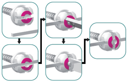 Spider Self-Ligating K1 1.5mm